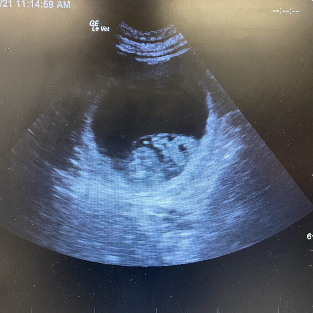 Lexi – Pregnancy Confirmed!